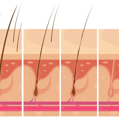 Znázornění čtyř fází růstu vlasů